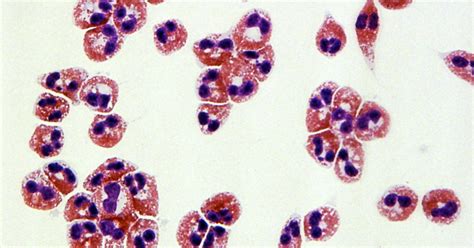 Human Eosinophils