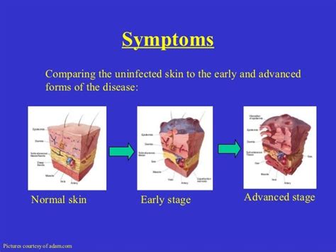 skin necrosis symptoms - pictures, photos