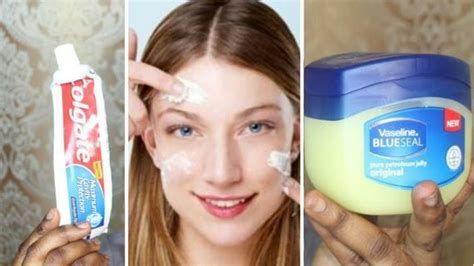 How To Get Rid Of Blackheads Using Vaseline Howtoremvo