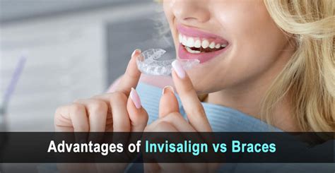 The Advantages Of Invisalign Vs Braces Larry Saylor Dentistry