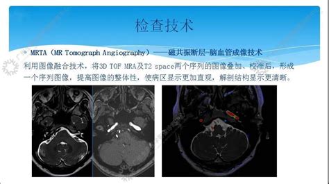 第二十六期：广州中心《颅颌面专场》影像技术评审会全景医学影像