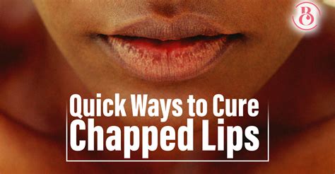 10 Quick Ways to Treat Chapped Lips - BeauCrest