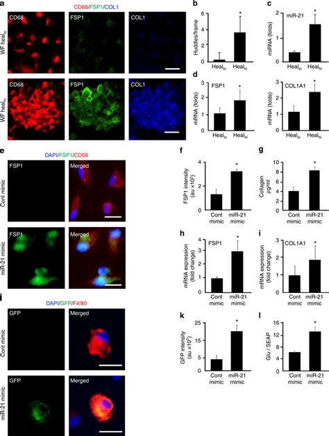 Conversion Of Wound Macrophages To Fibroblast Like Cells Require