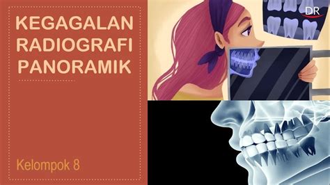 Presentasi Kelompok A Kegagalan Radiografi Panoramik Youtube