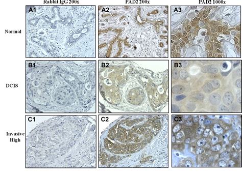 Figure 1 From Comparative Analysis Of Peptidylarginine Deiminase 2