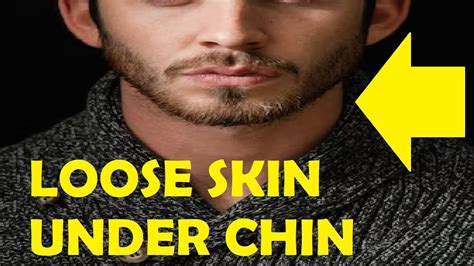 How To Get Rid Of Loose Skin Under Chin Without Surgery YouTube