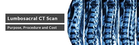 Lumbosacral Ct Scan Purpose Procedure And Cost Ganesh Diagnostic