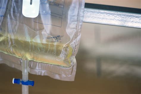 How To Change A Catheter Leg Bag Video At Clifford Ellingson Blog