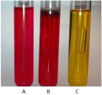 Lab Phenol Red Carbohydrate Broths Flashcards Quizlet