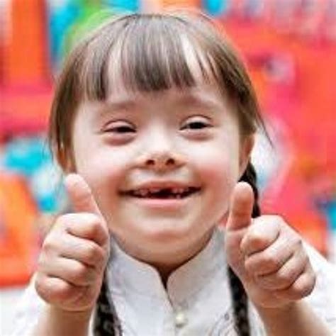 Stream Down Syndrome In Adapted Physical Education By What S New In Adapted Physical Education