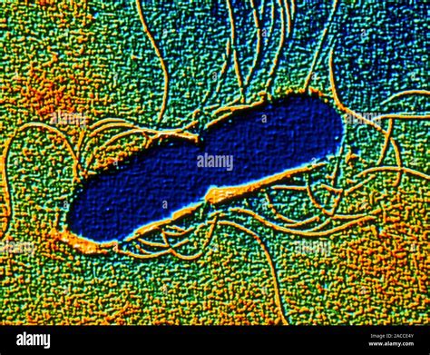 Intoxicación Alimentaria Bacteria Color Análisis Micrografía De