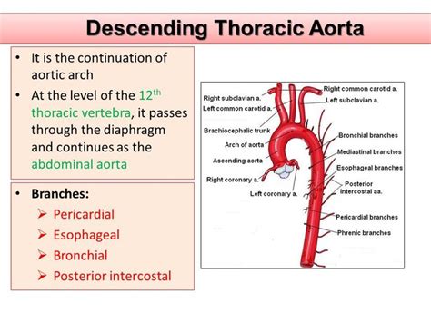 Descending Thoracic Aorta | Abdominal aorta, Thoracic, Thoracic vertebrae