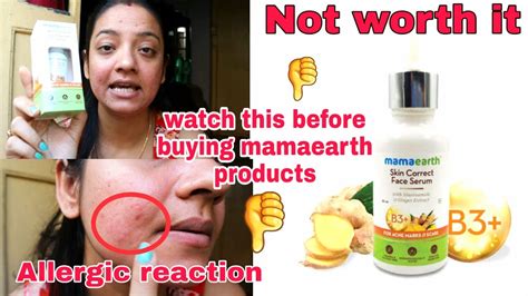 Mamaearth Skin Correct Face Serum I Will Never Buy Again Most Honest