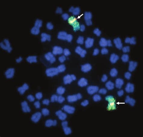 A Typical 64 XX Cell As Revealed By Fluorescence In Situ Hybridization