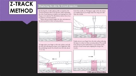 PPT - NUR 113: SKILL 22-4 ADMINISTERING INTRAMUSCULAR INJECTIONS ...