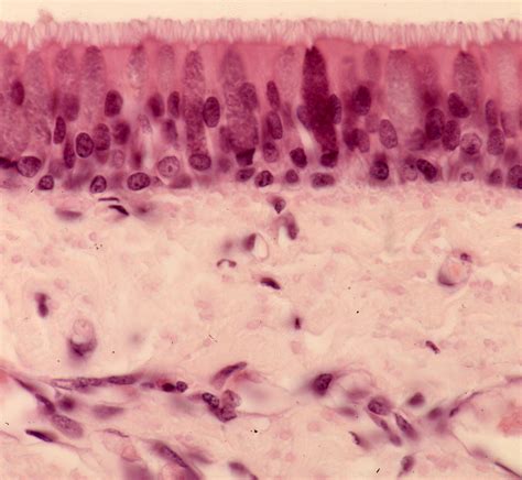 Epitelio Pseudoestratificado Ciliado Mancia Org Atlas