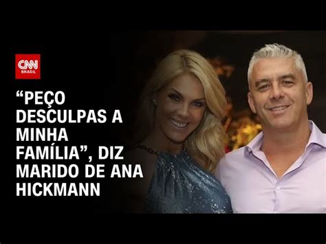 Marido De Ana Hickmann Se Pronuncia Sobre Acusação De Agressão “peço