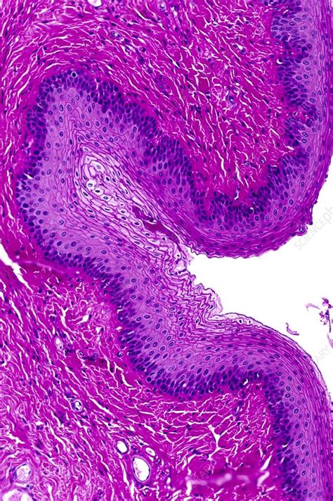 Stratified squamous epithelium - Stock Image - C016/0534 - Science ...