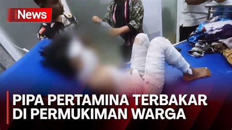 Pipa Pertamina Bocor Di Belawan 2 Orang Luka Bakar YouTube