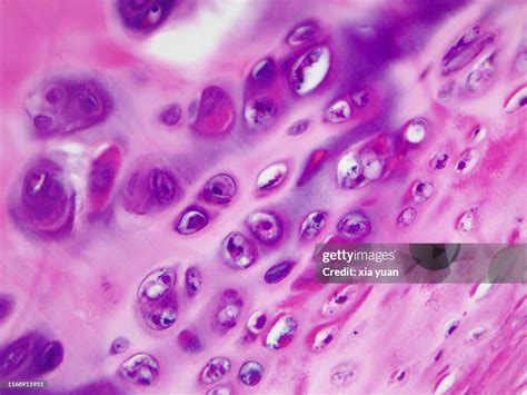 Hyaline Cartilage 40x Light Micrograph High Res Stock Photo Getty Images