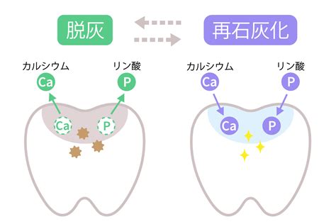 【フッ素の重要性】虫歯予防におけるフッ素の効果を分かりやすく解説 北戸田coco歯科｜戸田市の歯医者