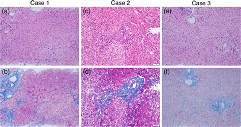 Histopathological Findings Hematoxylin And Eosin Staining Of Liver