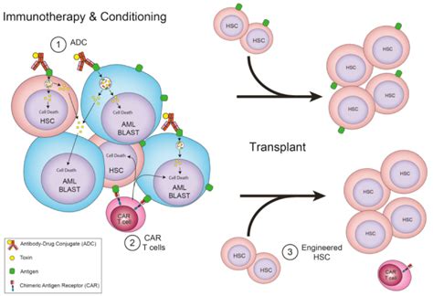 JCM Free Full Text Is Hematopoietic Stem Cell Transplantation