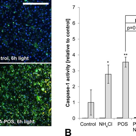 Blue Light Irradiation Of Lipofuscin Loaded Rpe Cells Causes Phototoxic