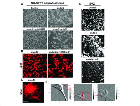 Neuroblastoma Cells Of A Sh Sy Y Cell Line Treated With Endo N Which