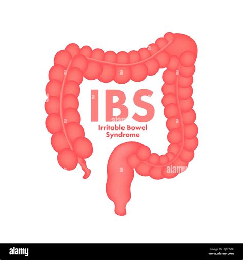 S Ndrome Del Intestino Irritable Signos Del Ibs Mensajes De Salud