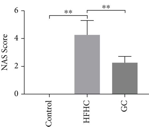 Gc Reversed Liver Steatosis Inflammation And Fibrosis In Hfhc Induced