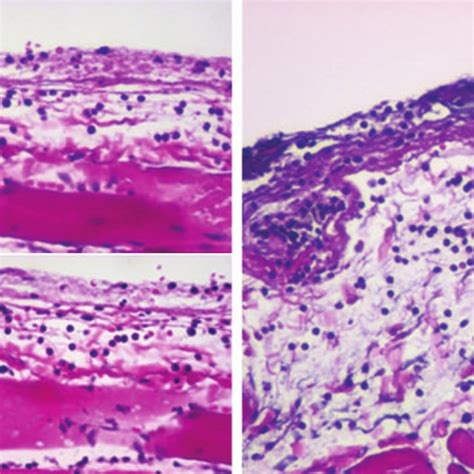 Light Micrographs Of Hematoxylin And Eosin Stained Capsule Tissue At 24