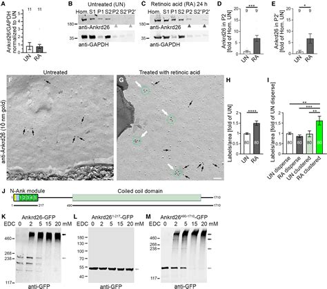 Ankrd26 Is A Retinoic Acid Responsive Plasma Membrane Binding And