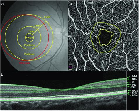 A The Software Of Optical Coherence Tomography Angiography Octa