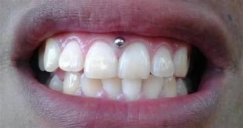 Gum Piercing: Why It’s A Threat To Your Oral Health | Longevita