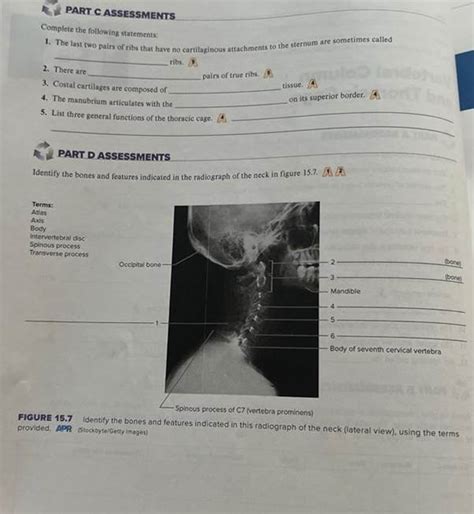 Solved Vertebral Column And Thoracic Cage Part A Assessments