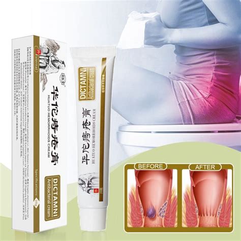 Antibacterial Herbal Hemorrhoids Buasir Cream G Natural Chinese