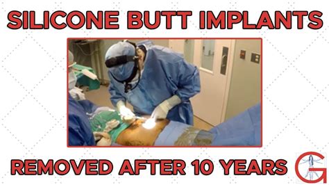 Silicone Butt Implants Removed After Years Dr Michael Gartner