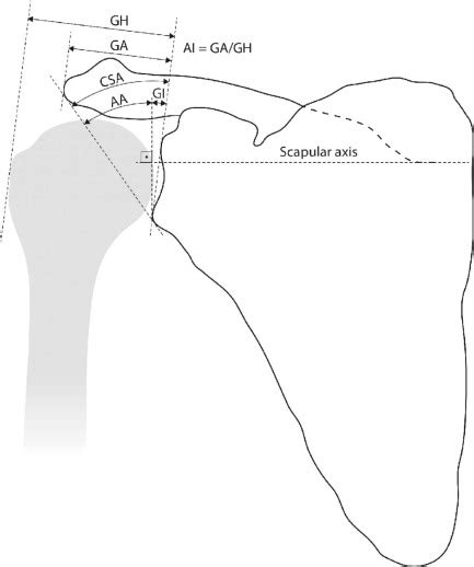 Effects Of Glenoid Inclination And Acromion Index On Humeral Head