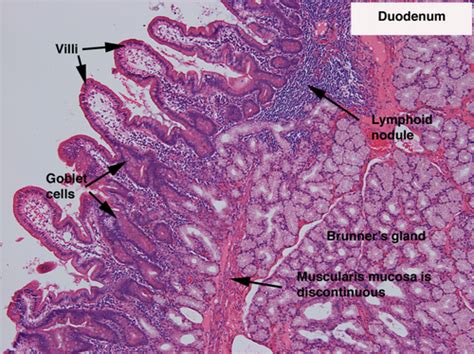 Paroi Intestinale Flashcards Quizlet