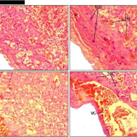 Photomicrograph Of Labyrinth Zone Of The Placenta Control Group Upper