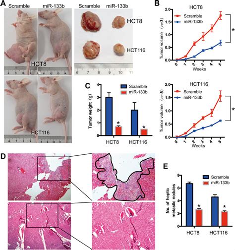 MiR 133b Suppresses CRC Tumorigenesis And Metastasis In Vivo HCT8 And