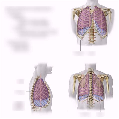 Costomediastinal Recess