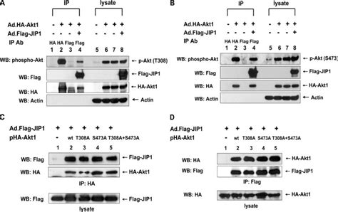 Phosphorylation Of Akt On Thr 308 And Ser 473 And Its Role In The