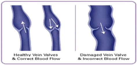 Venous Anatomy Center For Venous Disease