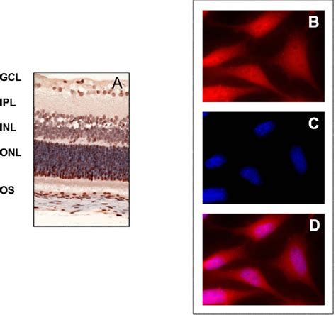 Figure 1 from The role of calcium-activated protease calpain in ...