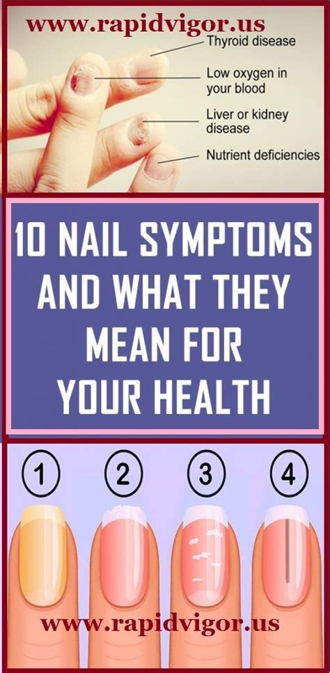 10 Nail Symptoms And What They Mean For Your Health Nail Symptoms