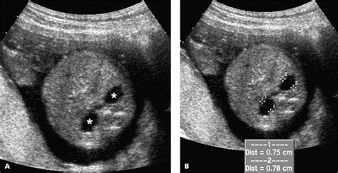 Genitourinary Tract Radiology Key