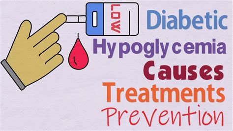 Diabetic Hypoglycemia Causes Treatments And Prevention Youtube