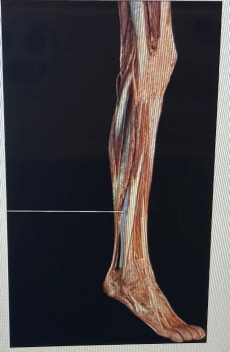 Solved Identify The Highlighted Muscle Chegg